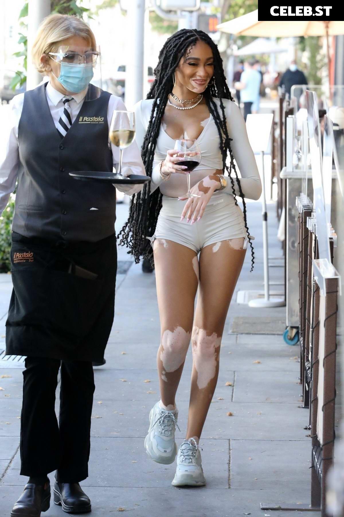 Winnie Harlow Image 1736644
