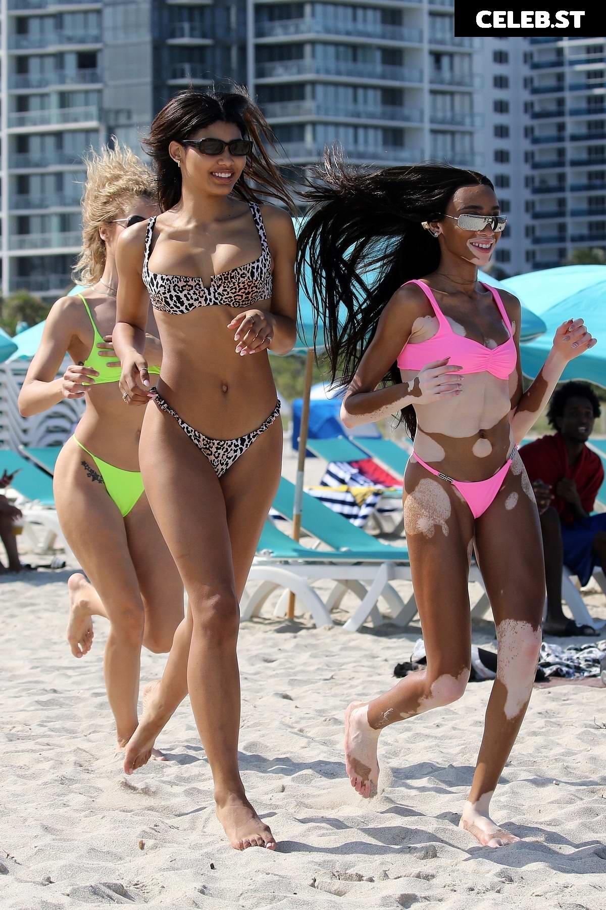 Winnie Harlow Image 1736665