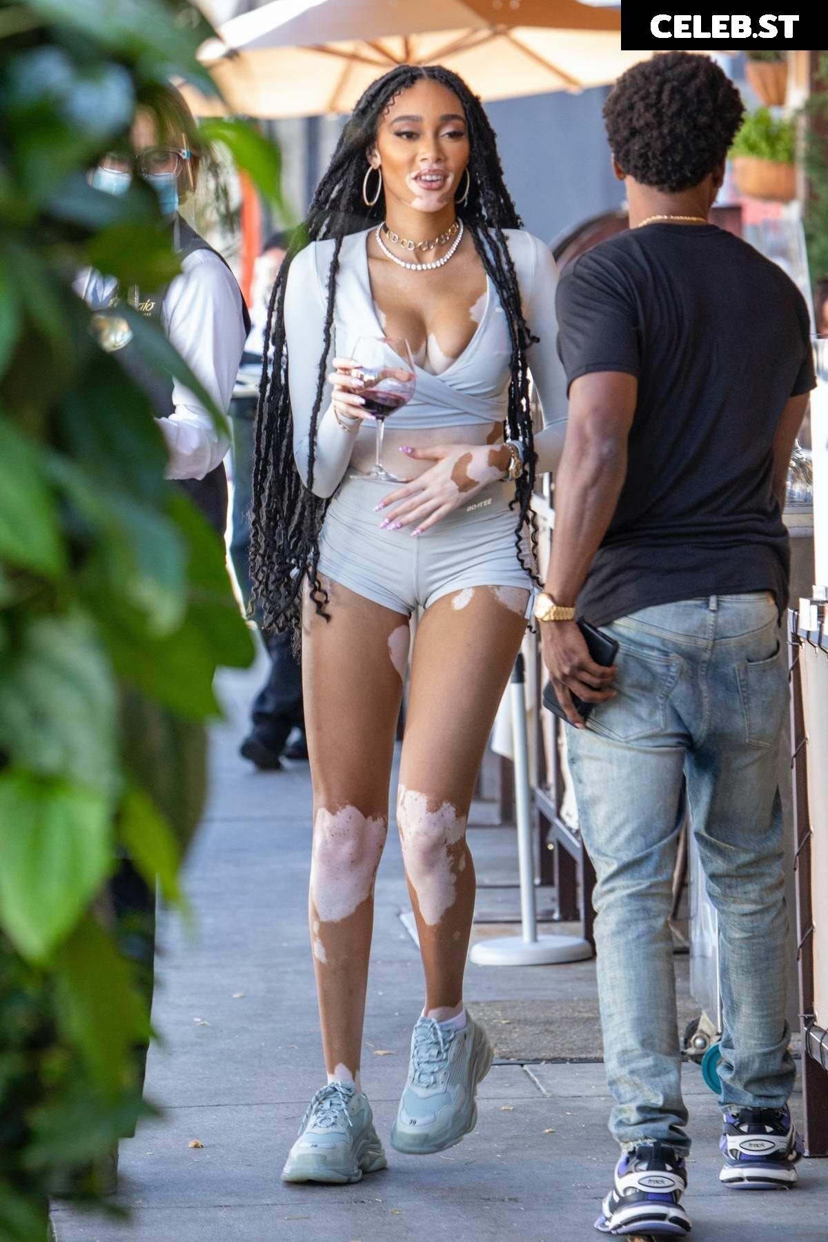Winnie Harlow Image 1736220