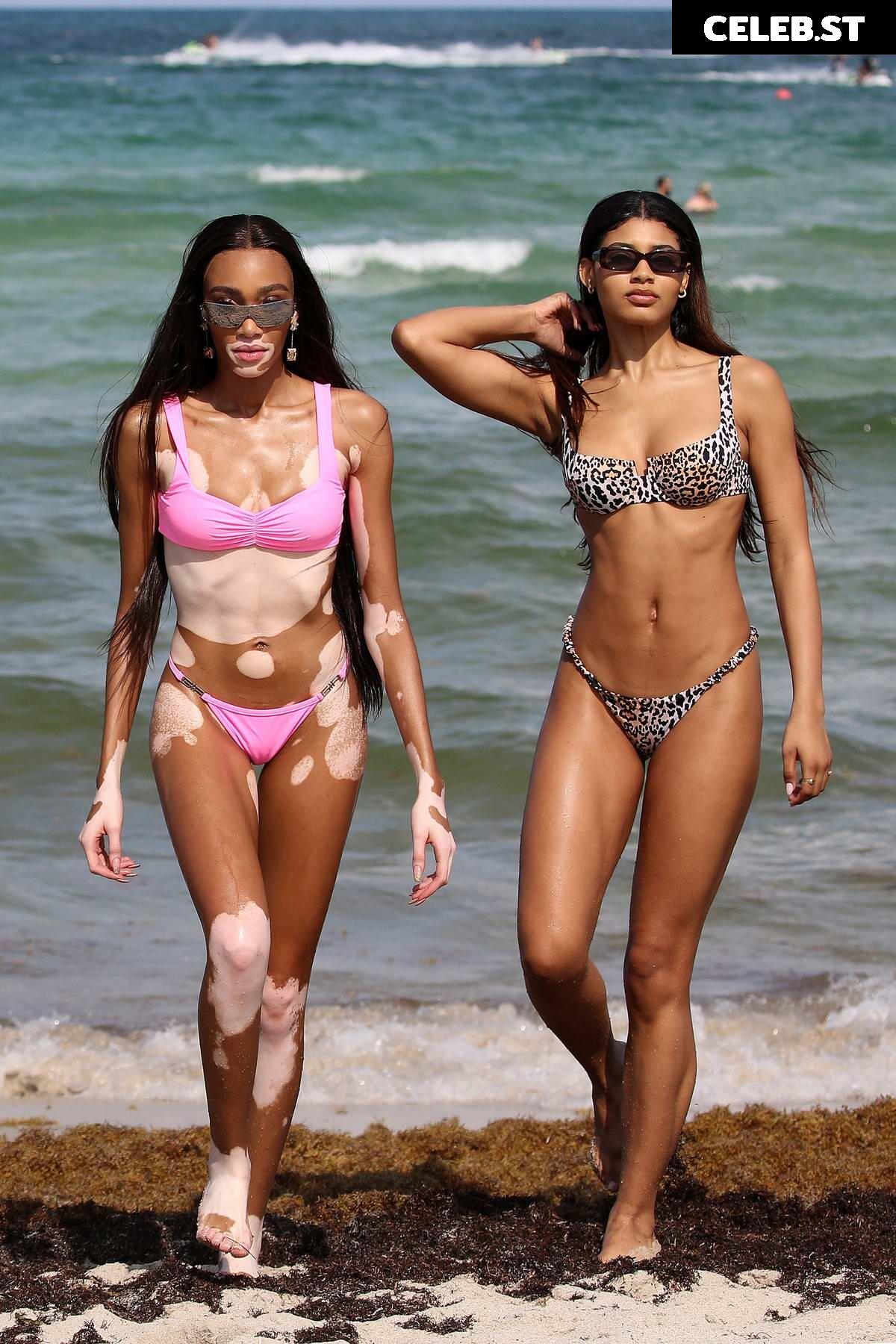 Winnie Harlow Image 1736908