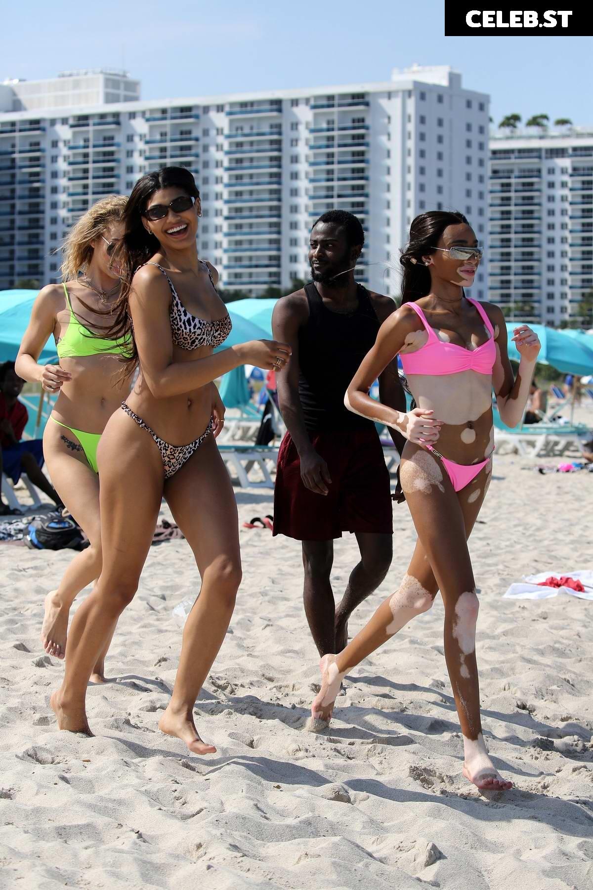 Winnie Harlow Image 1737164