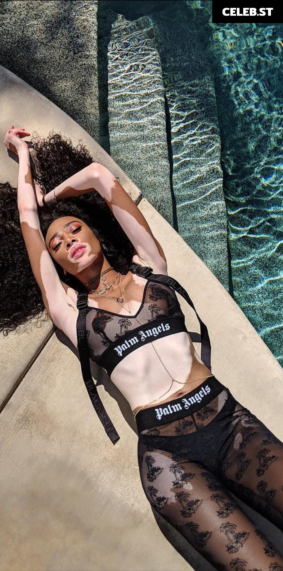 Winnie Harlow Image 1734168