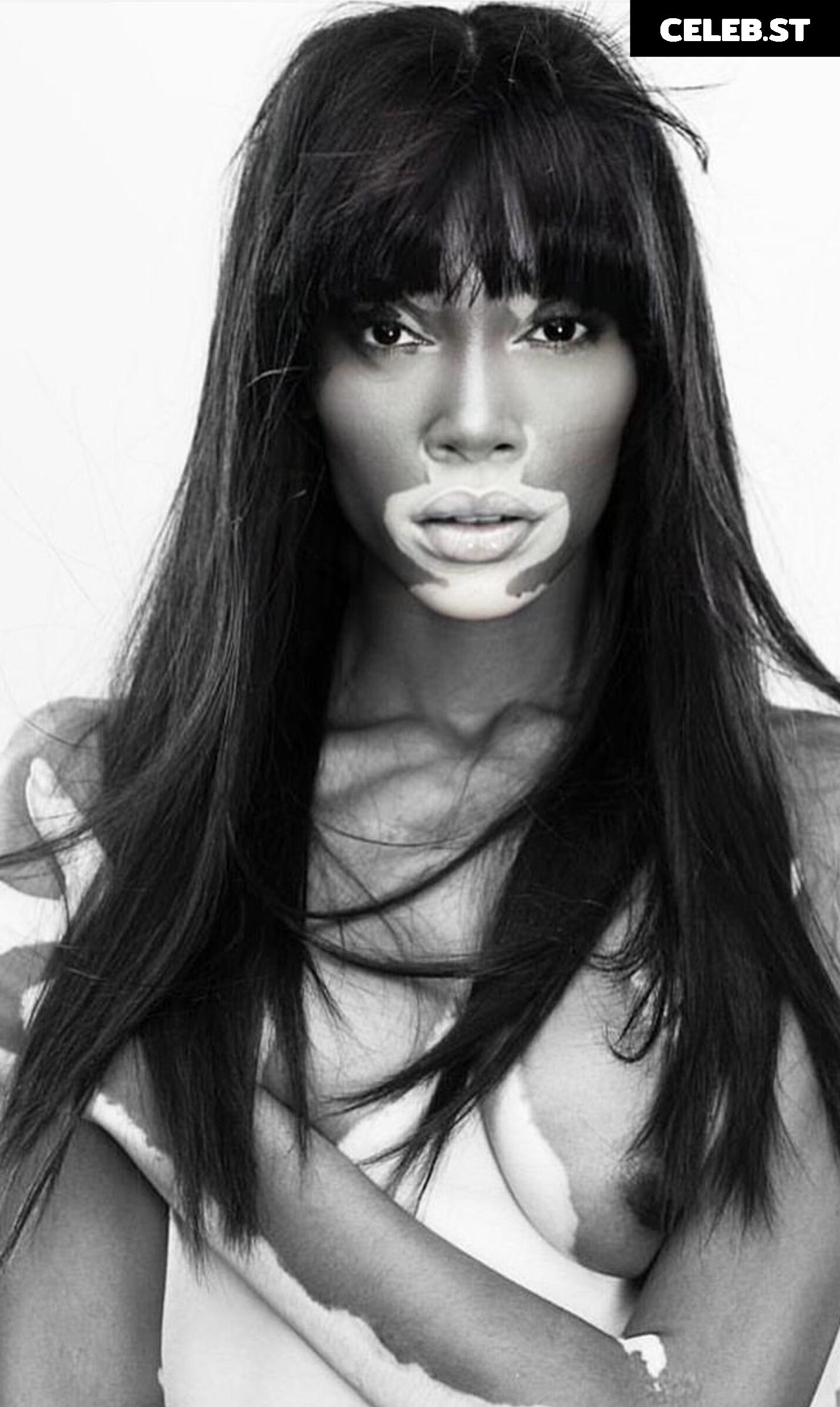 Winnie Harlow Image 1734132
