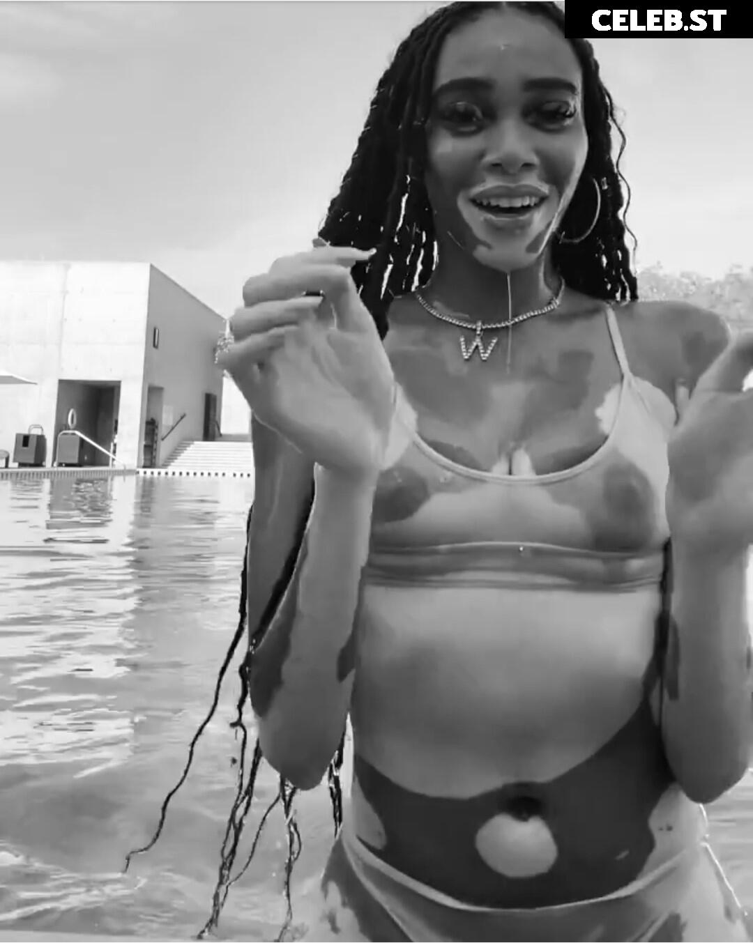 Winnie Harlow Image 1734048