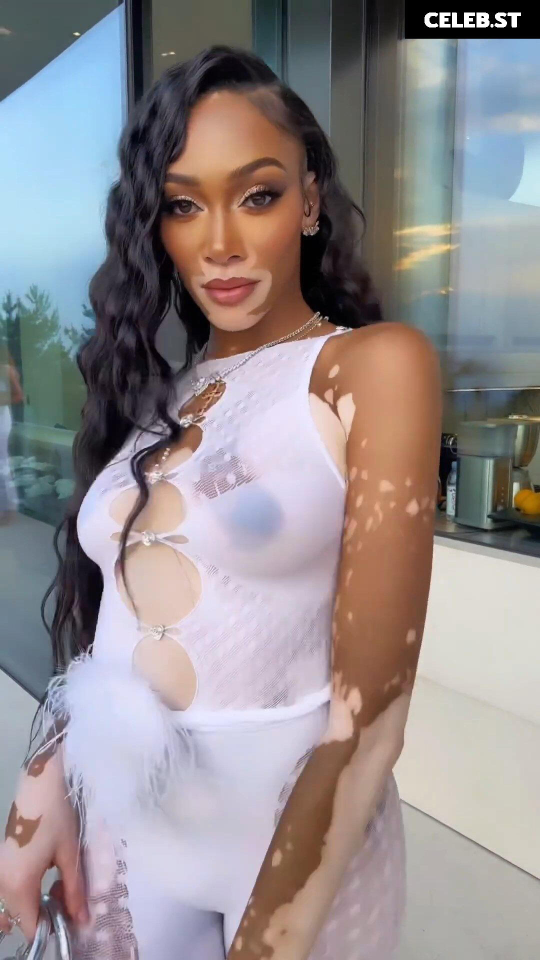 Winnie Harlow Image 1731856