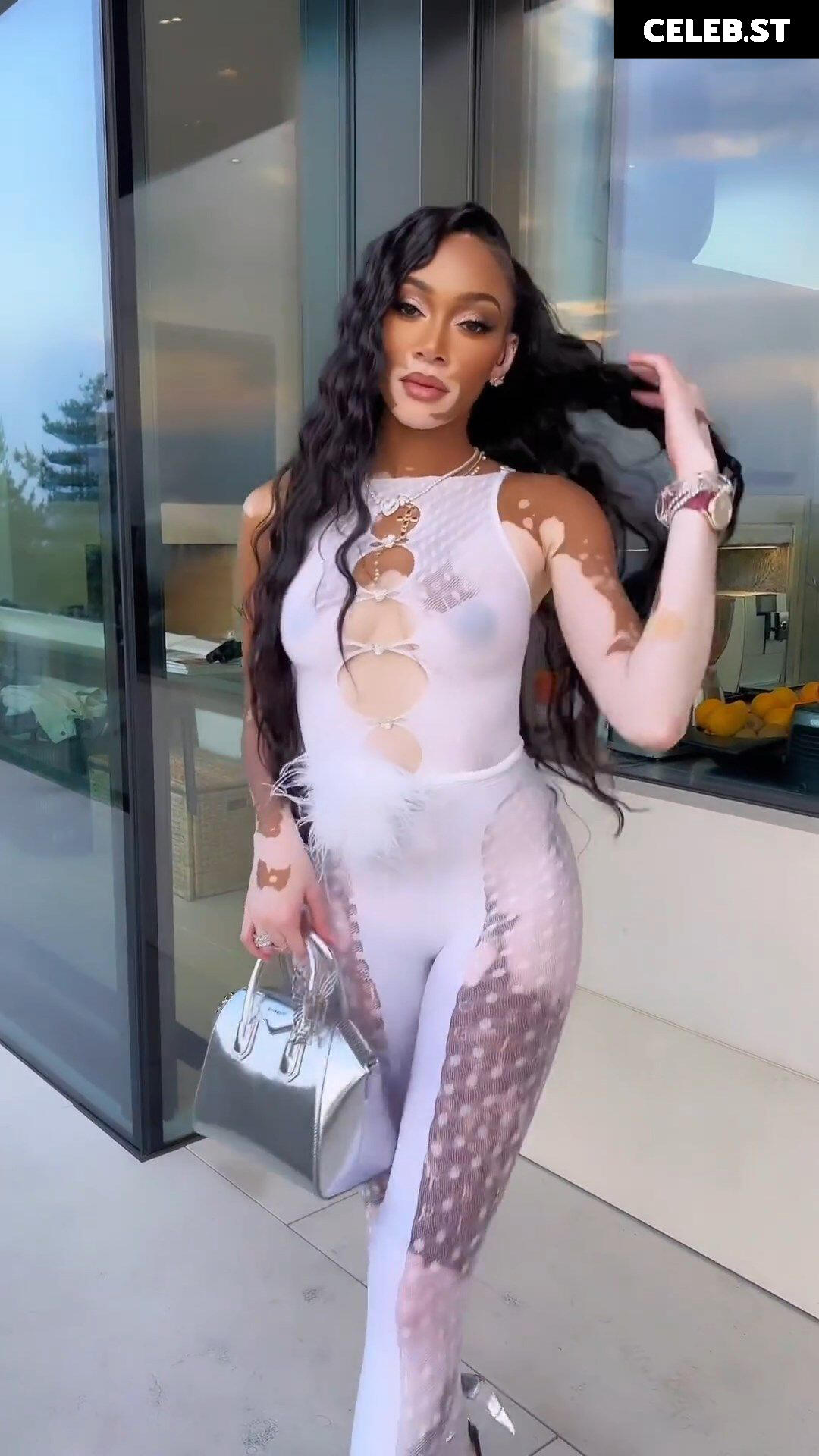 Winnie Harlow Image 1731843