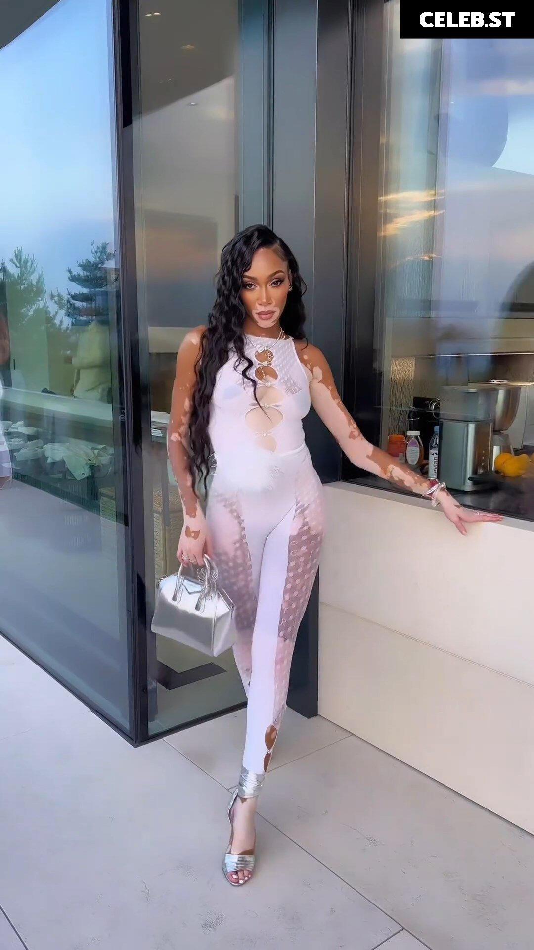 Winnie Harlow Image 1731819