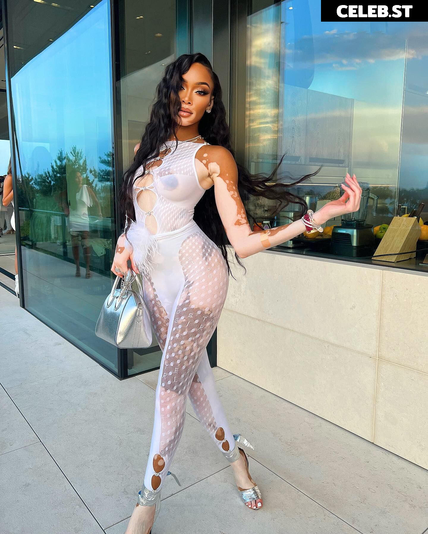Winnie Harlow Image 1731452
