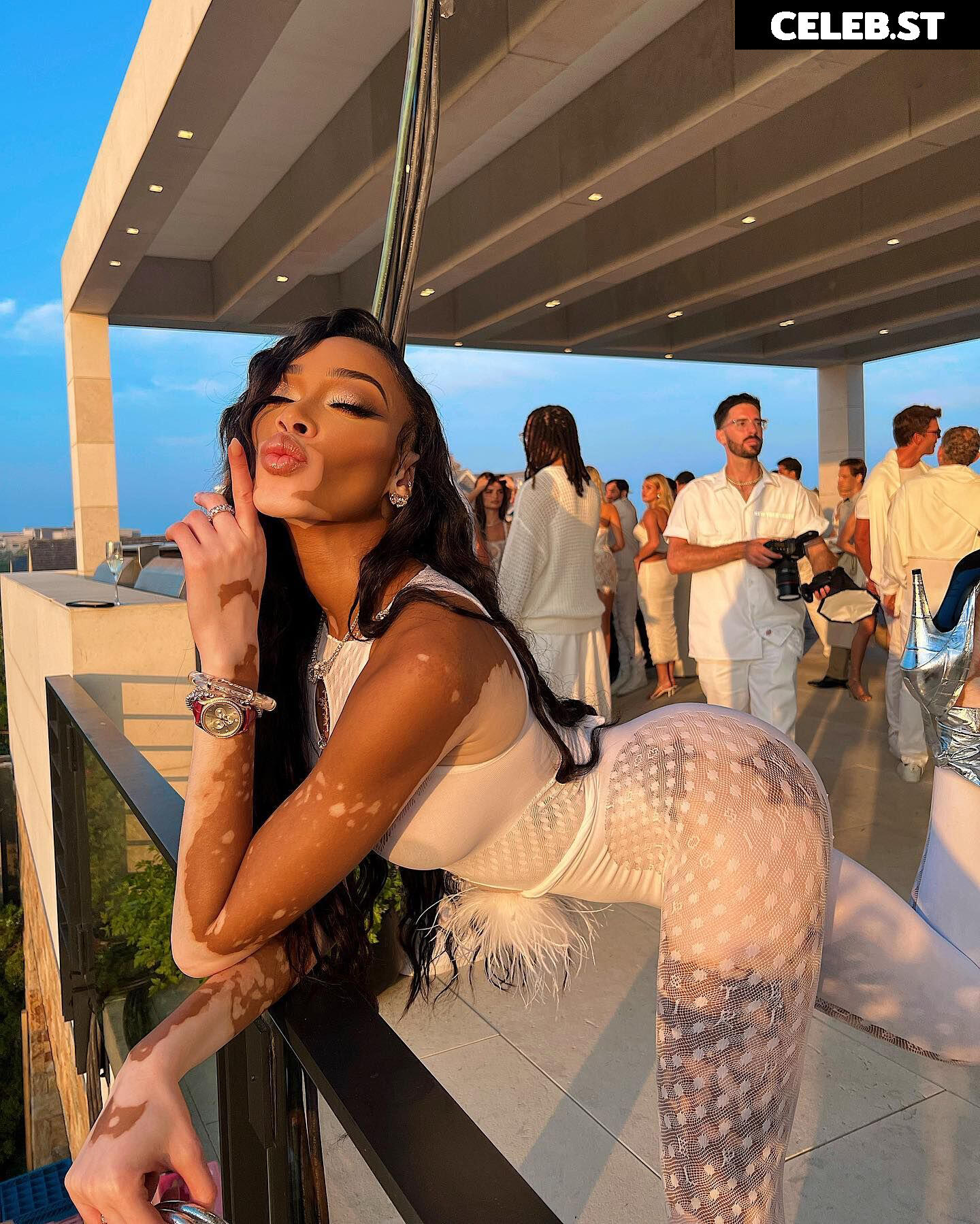 Winnie Harlow Image 1731478