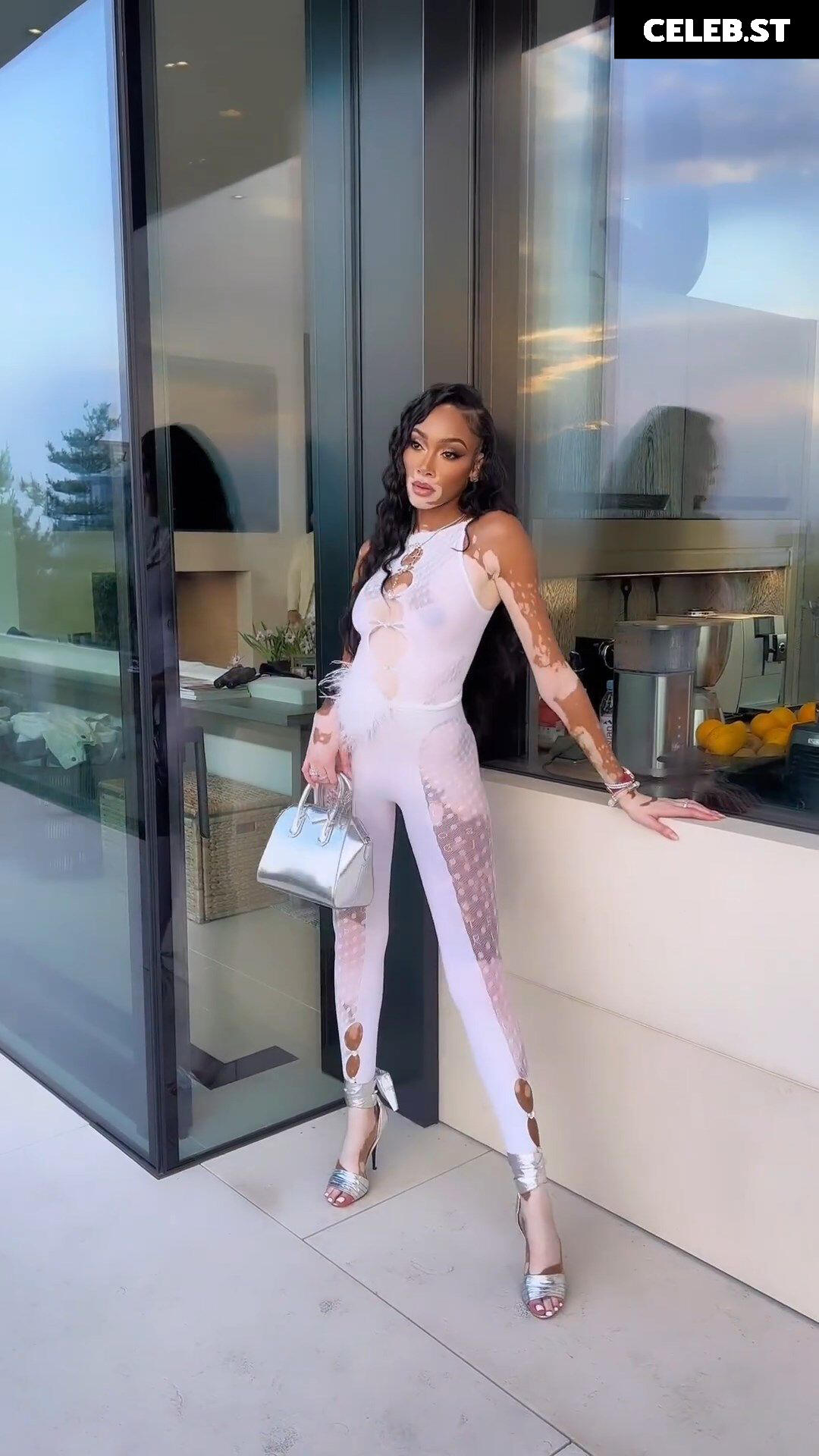 Winnie Harlow Image 1731799
