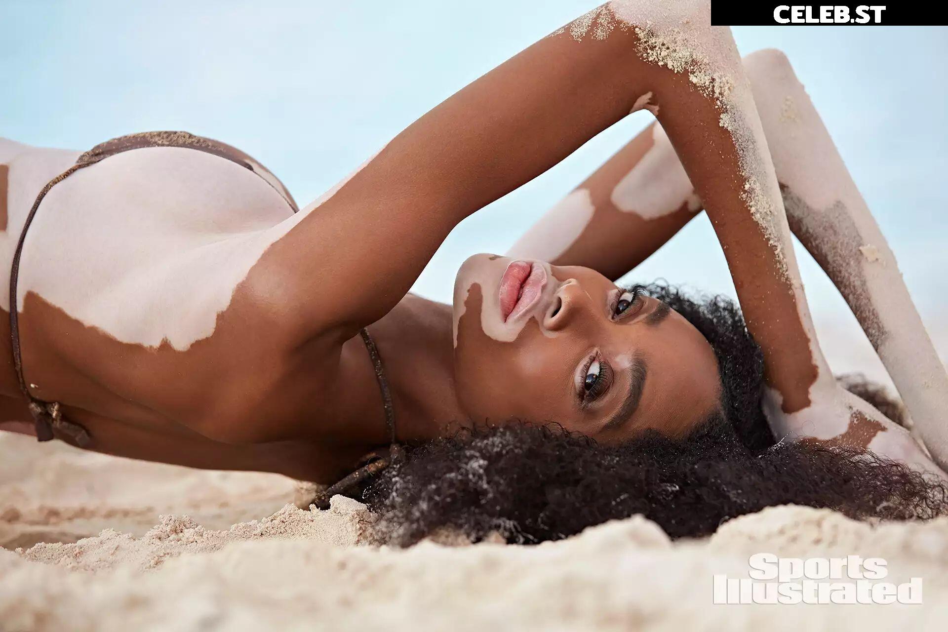 Winnie Harlow Image 1731156
