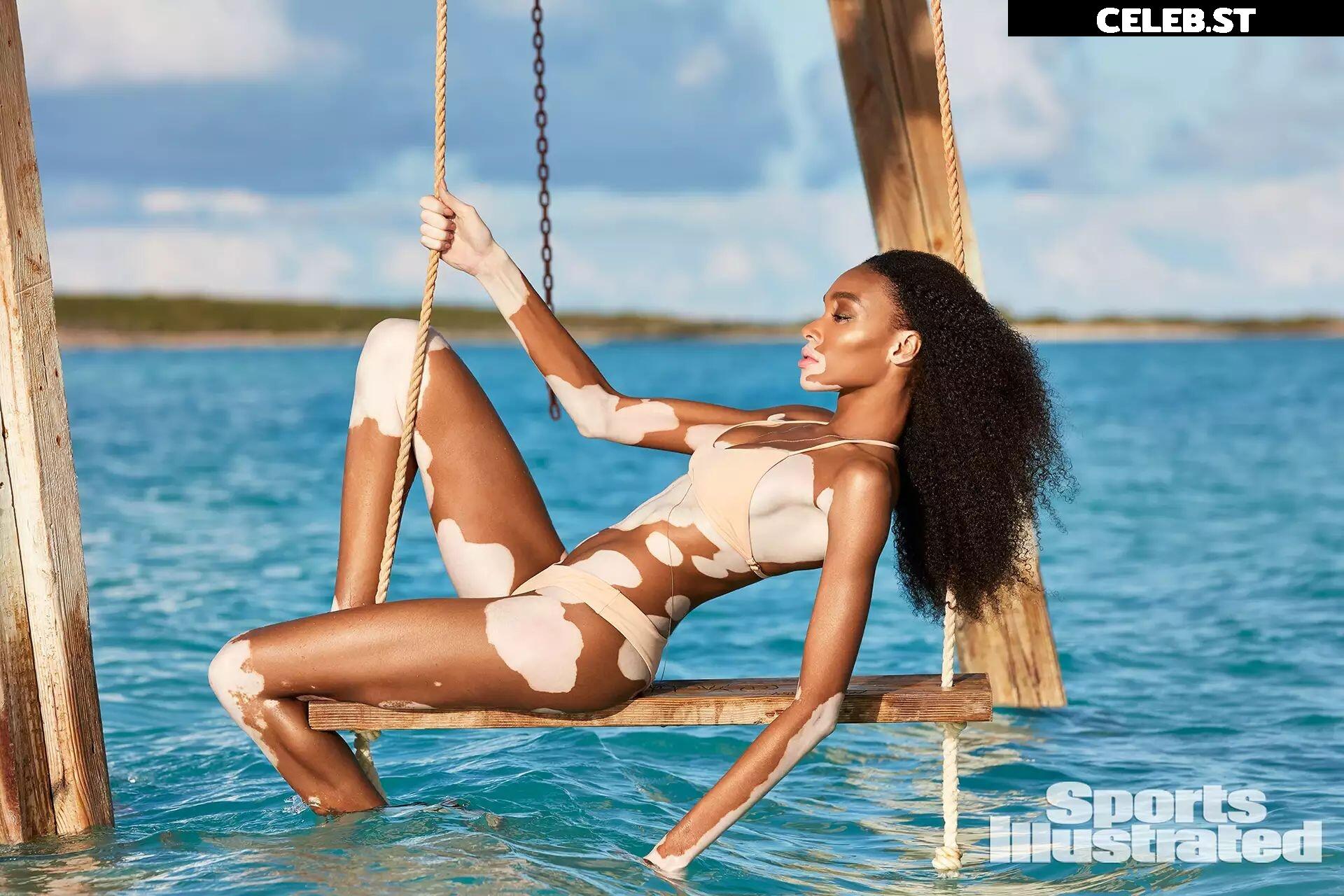 Winnie Harlow Image 1731105
