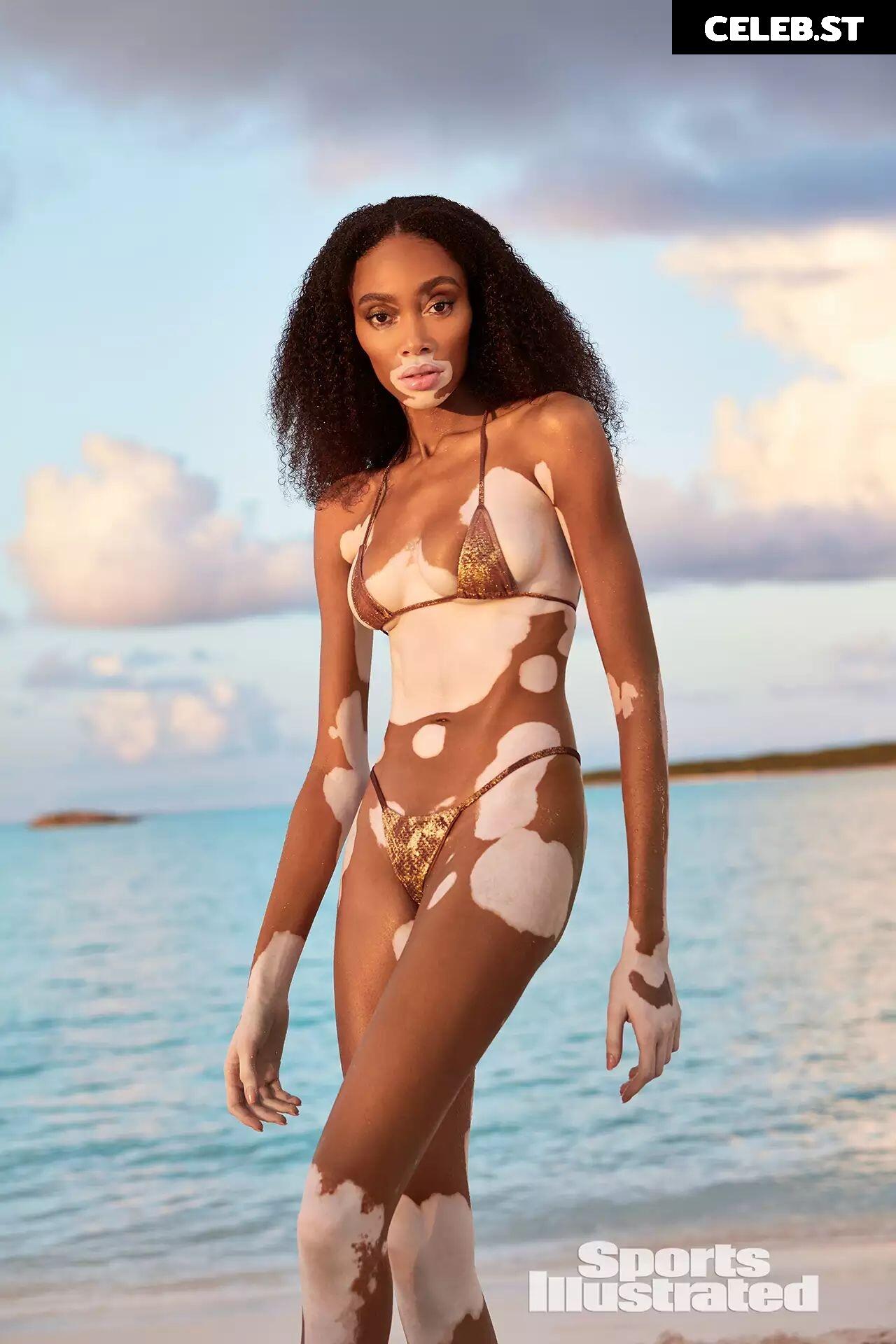 Winnie Harlow Image 1731129