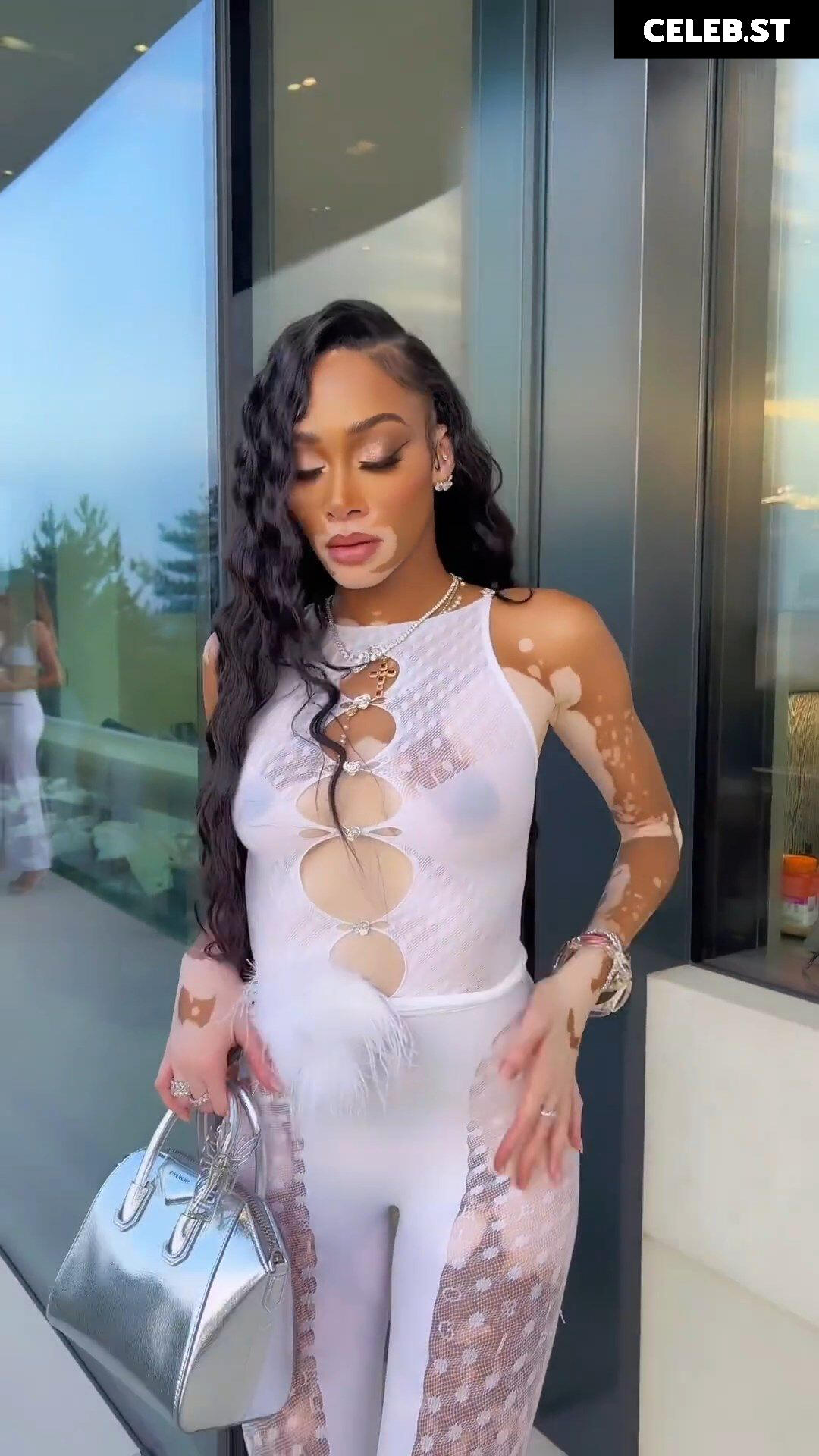 Winnie Harlow Image 1731306