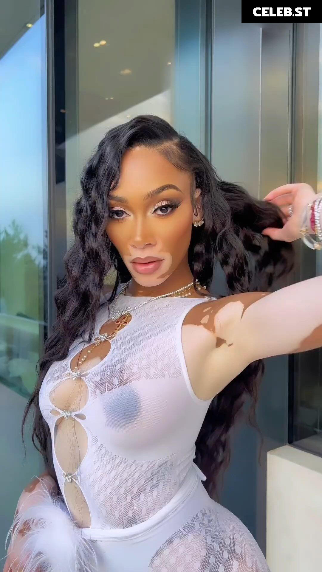 Winnie Harlow Image 1731332