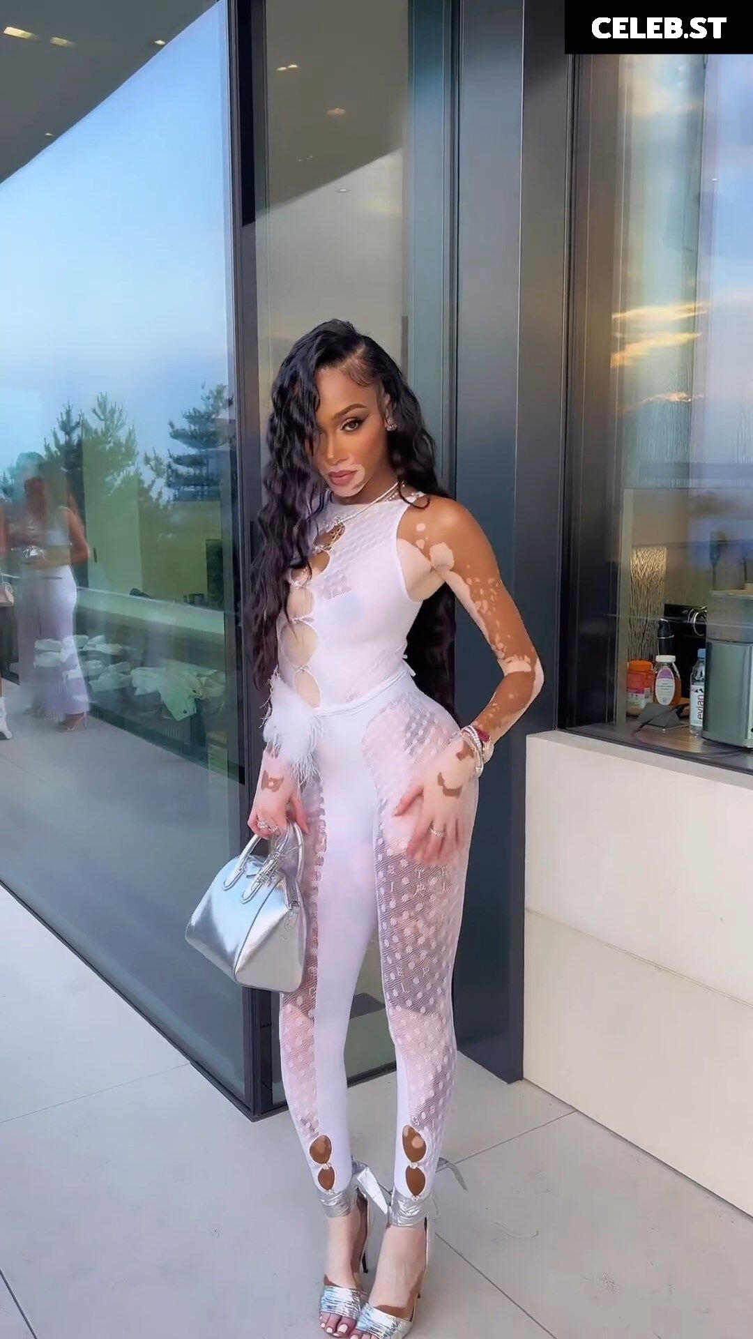 Winnie Harlow Image 1731268