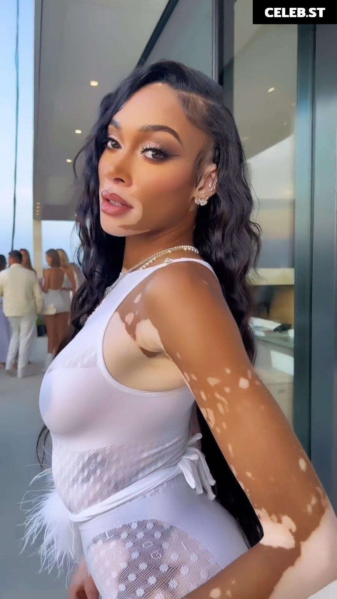 Winnie Harlow Image 1731978