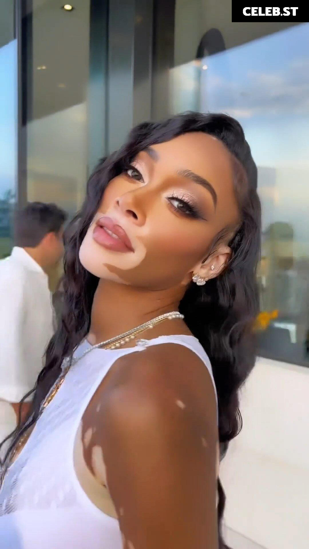 Winnie Harlow Image 1731963
