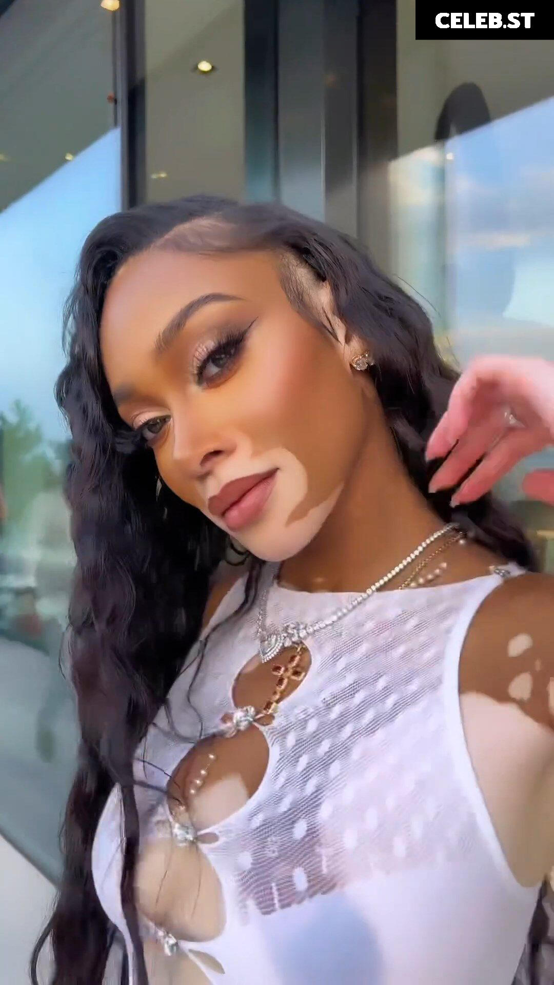 Winnie Harlow Image 1731923
