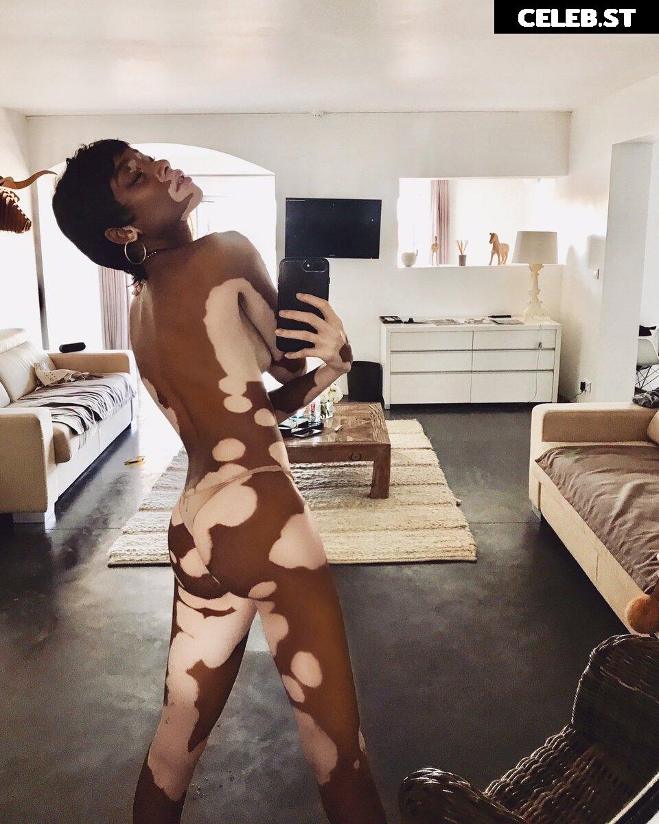 Winnie Harlow Image 1732850