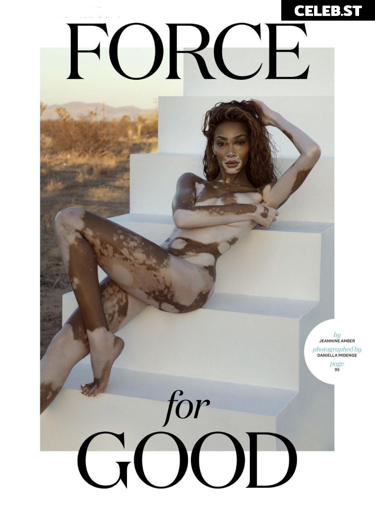 Winnie Harlow Image 1732562