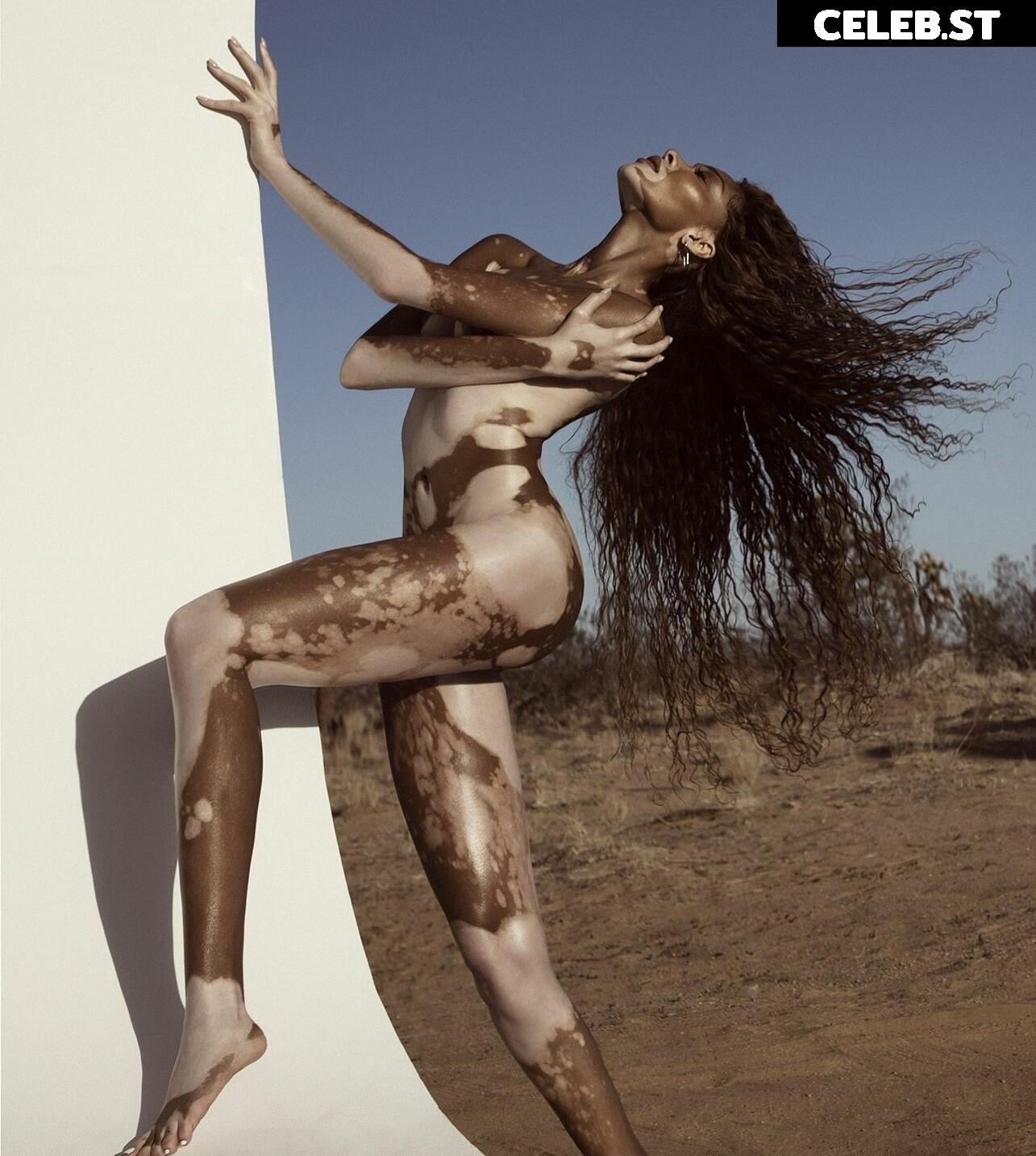 Winnie Harlow Image 1732485