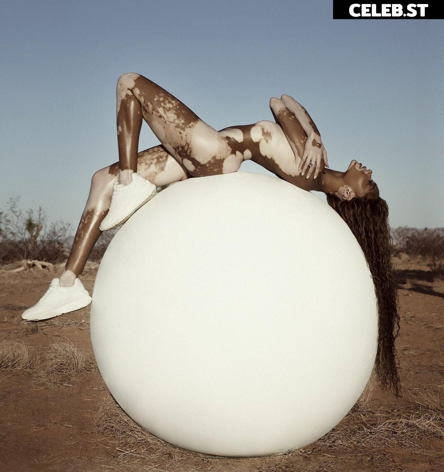 Winnie Harlow Image 1732461