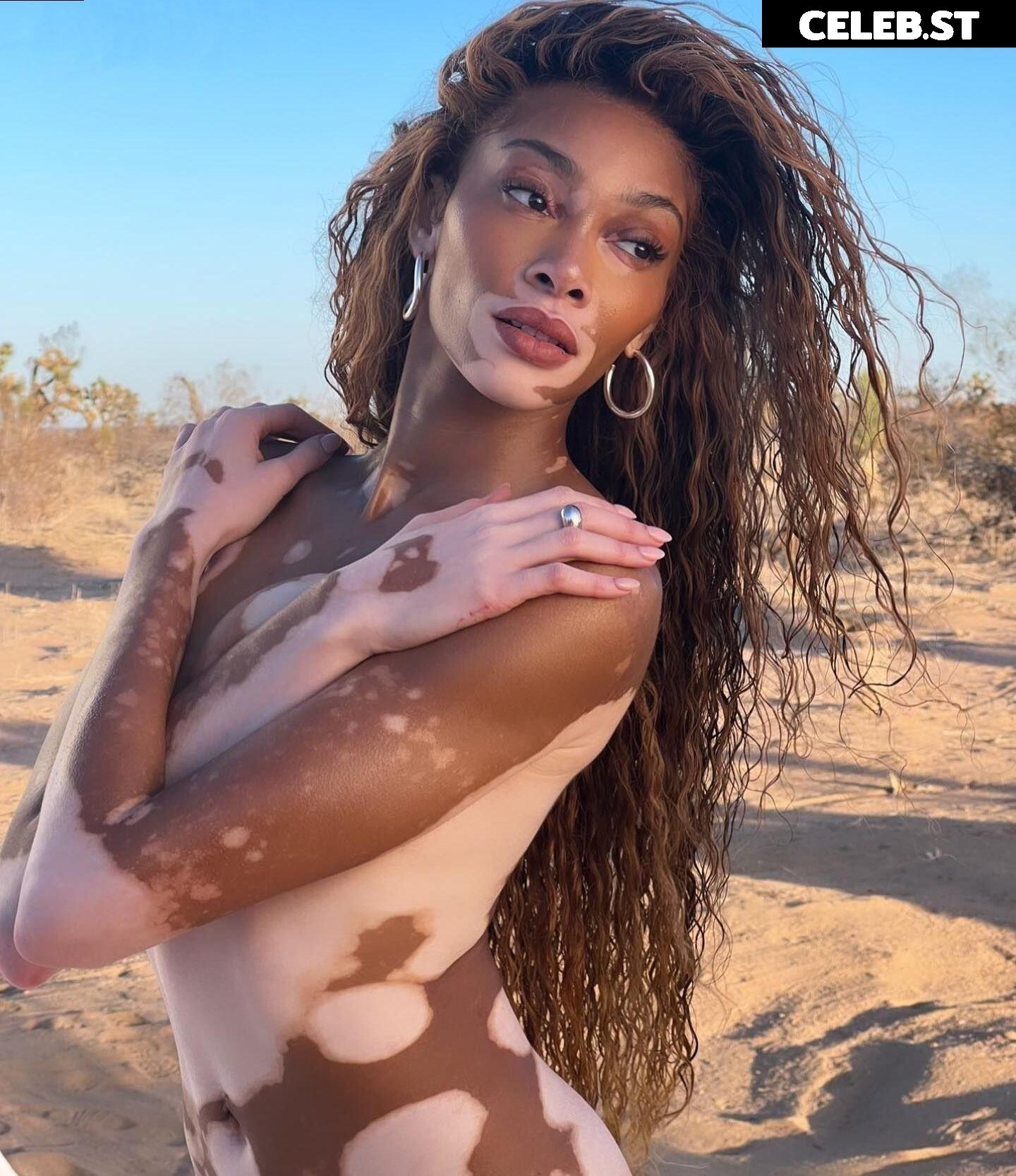 Winnie Harlow Image 1732426