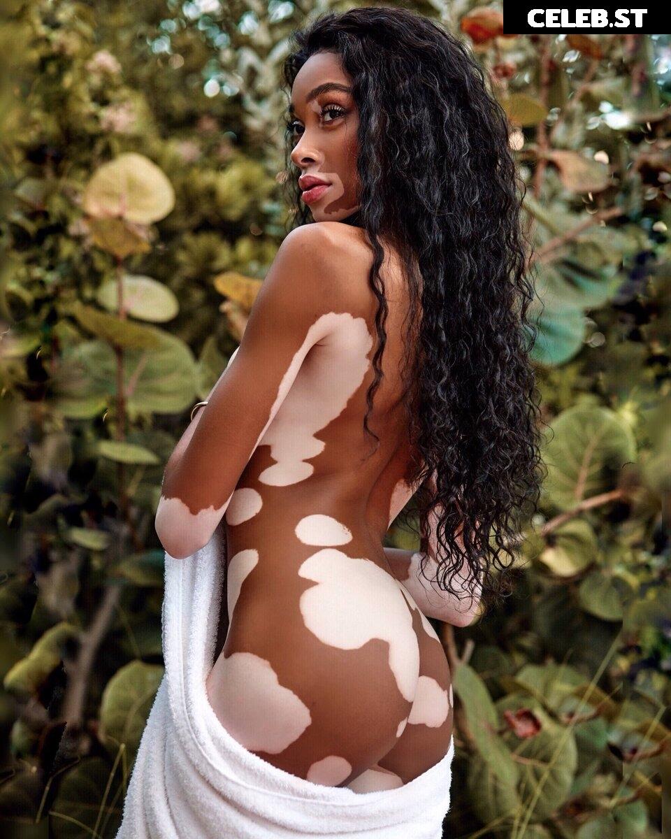 Winnie Harlow Image 1732782