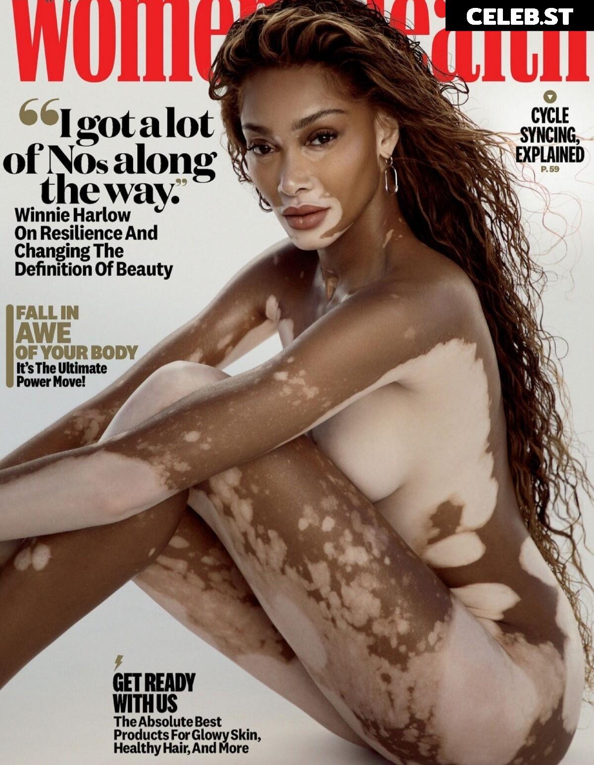 Winnie Harlow Image 1732041