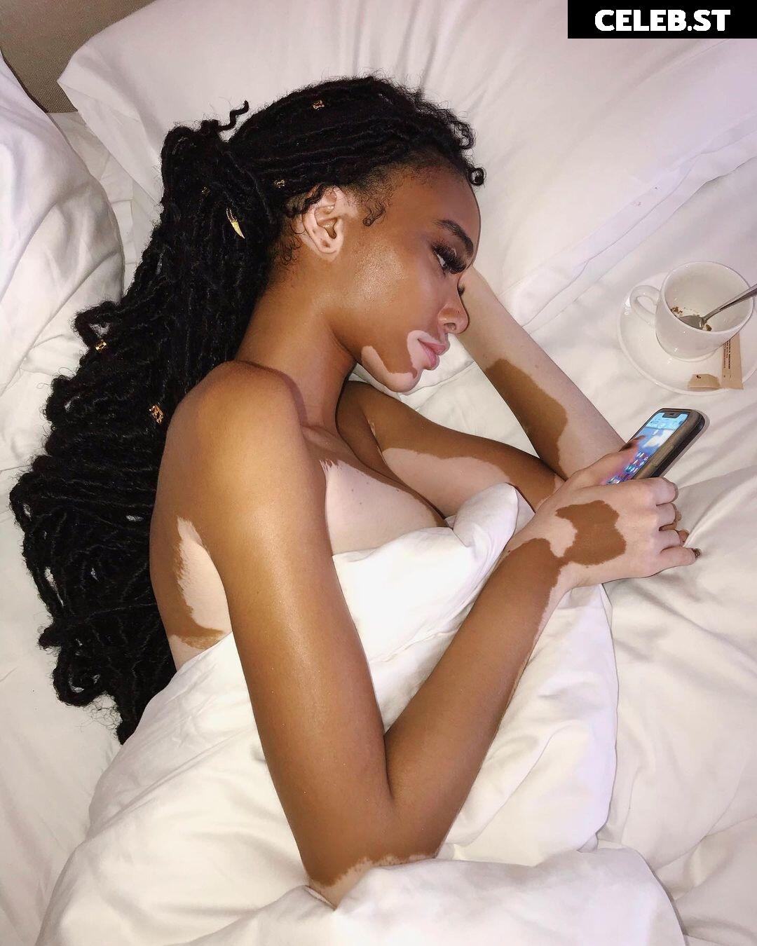 Winnie Harlow Image 1732015