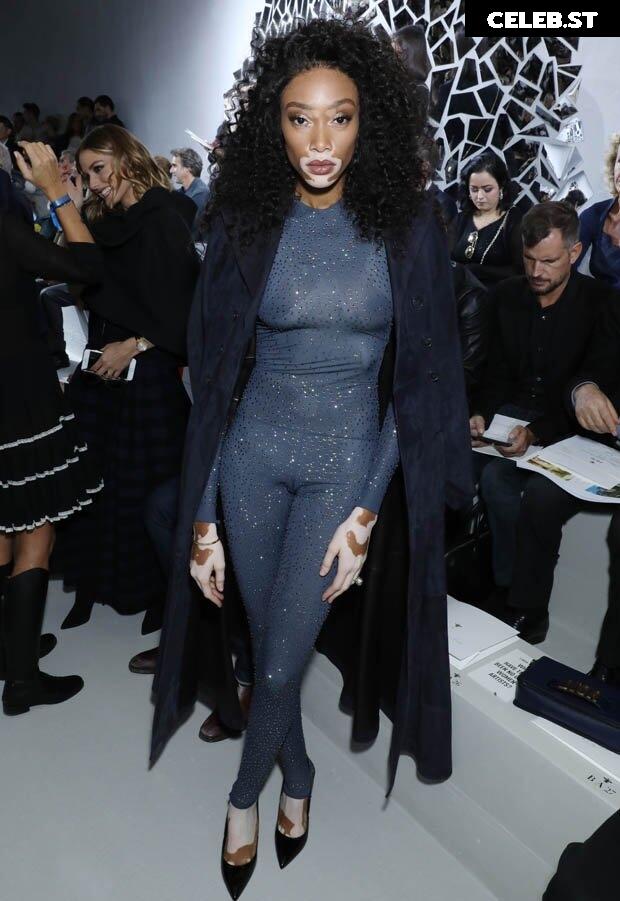Winnie Harlow Image 1732944