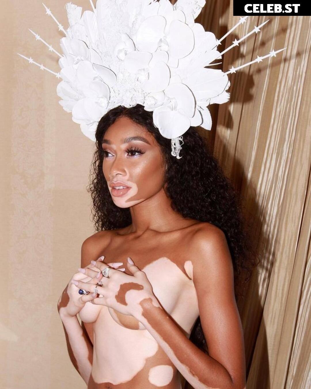 Winnie Harlow Image 1732905