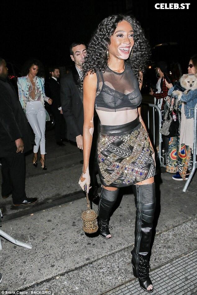 Winnie Harlow Image 1732931