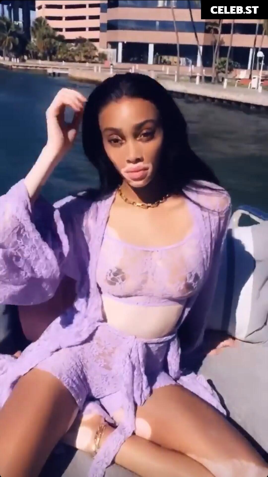 Winnie Harlow Image 1733850