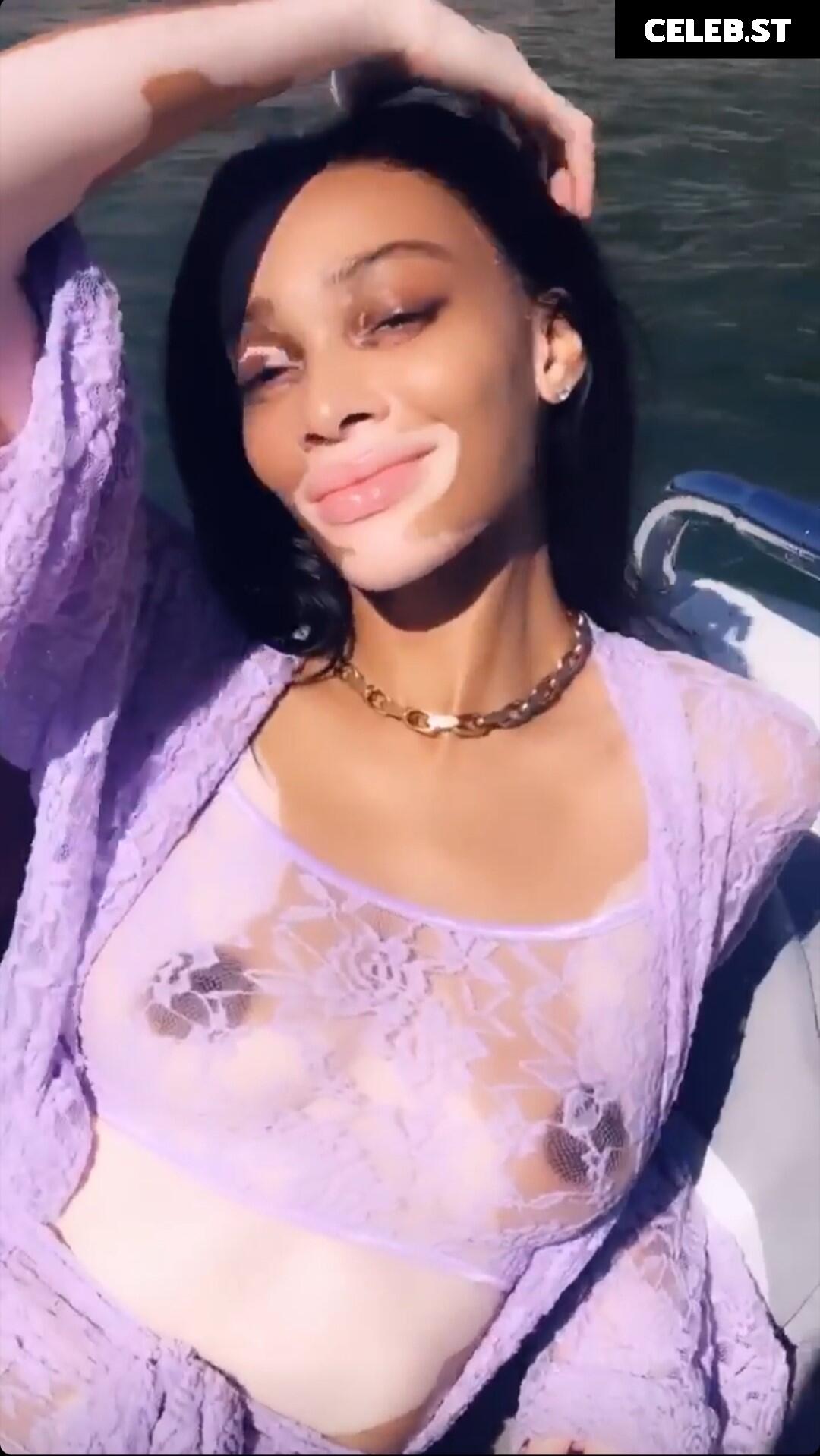 Winnie Harlow Image 1733801