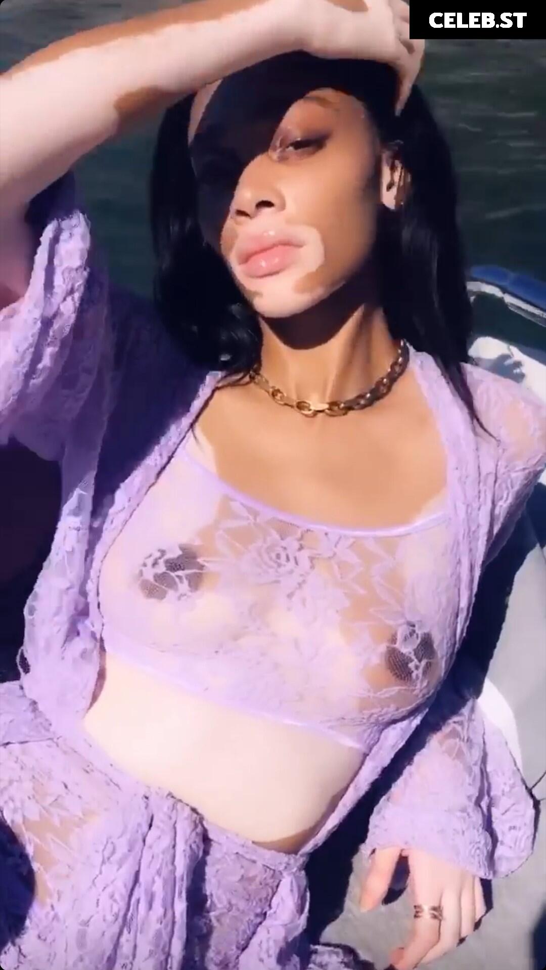 Winnie Harlow Image 1733781