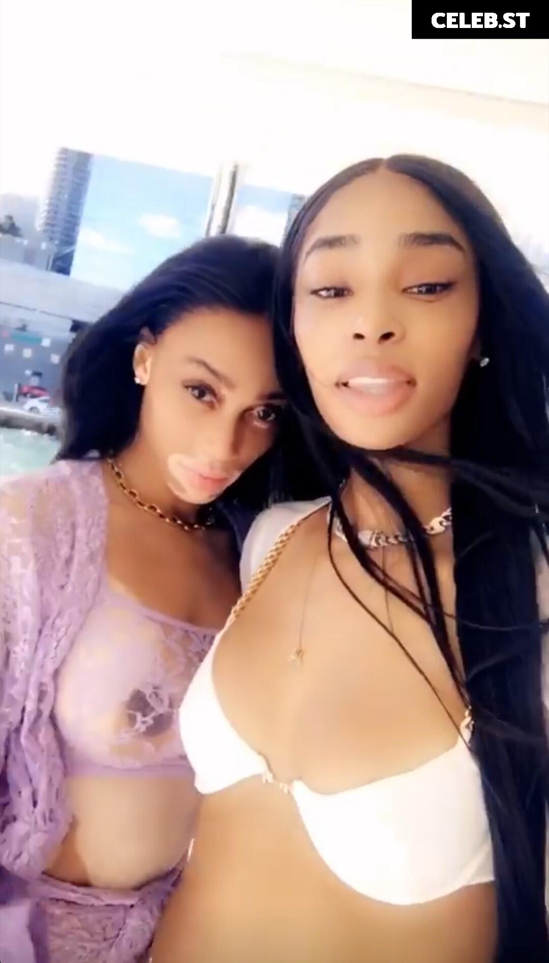 Winnie Harlow Image 1733748