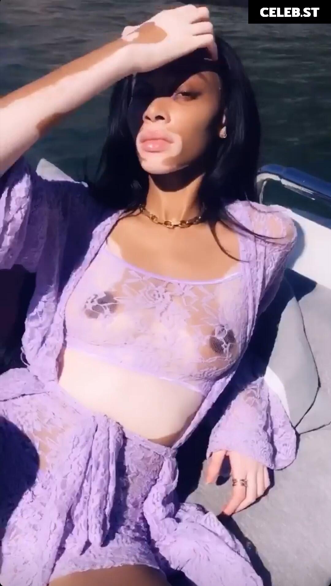 Winnie Harlow Image 1733763