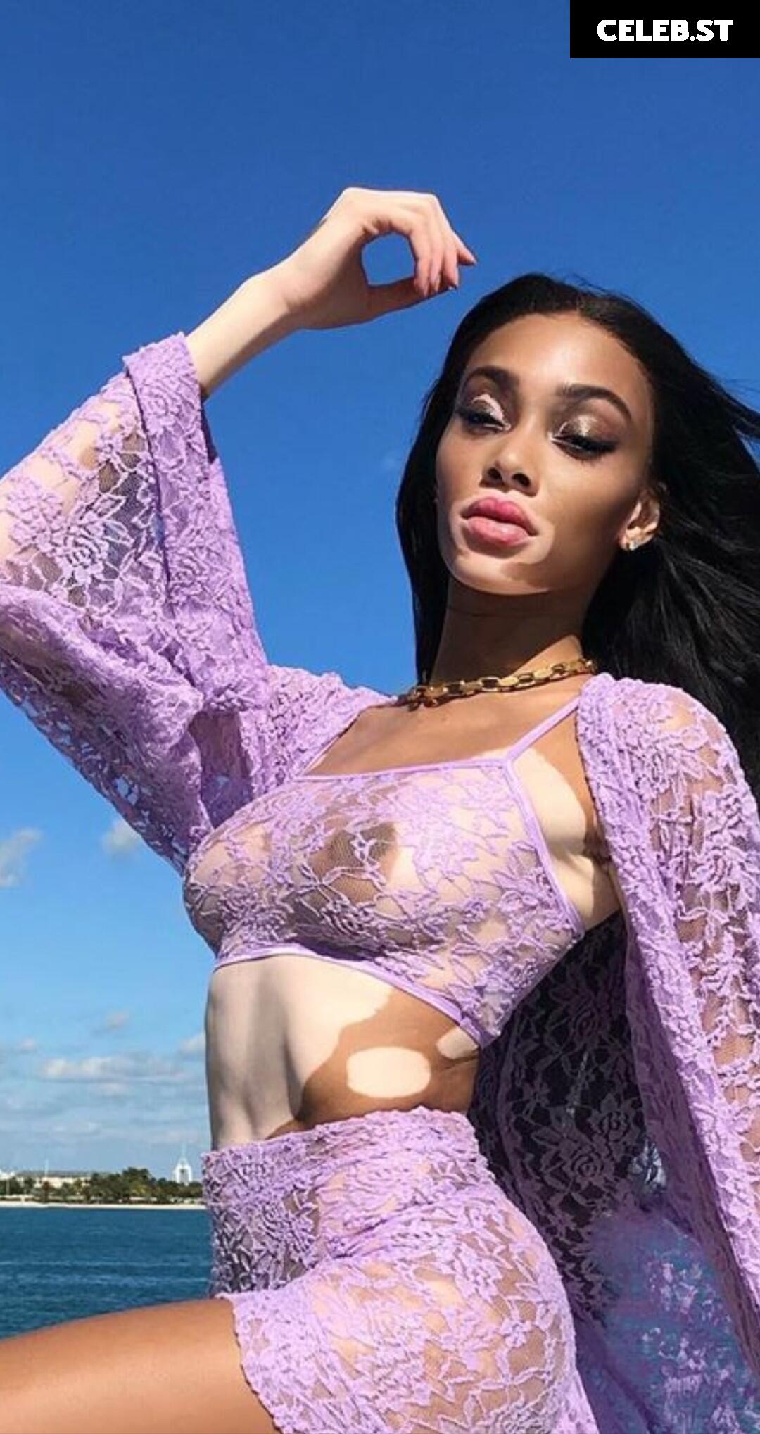 Winnie Harlow Image 1733709