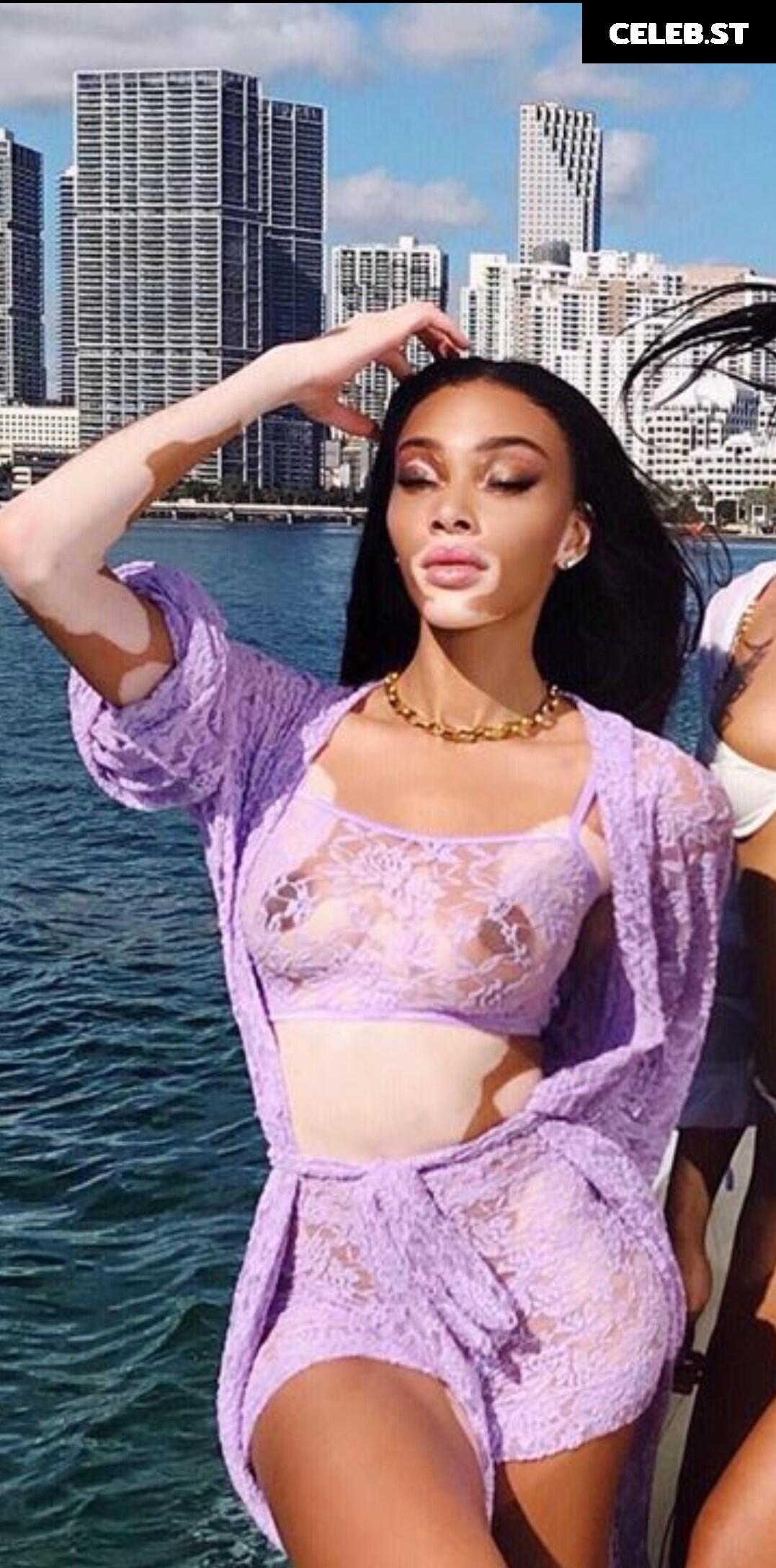 Winnie Harlow Image 1733734