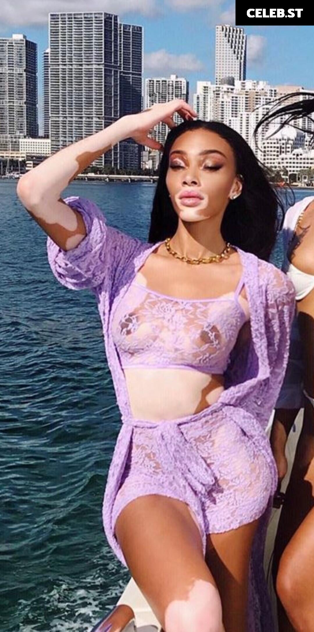 Winnie Harlow Image 1733655