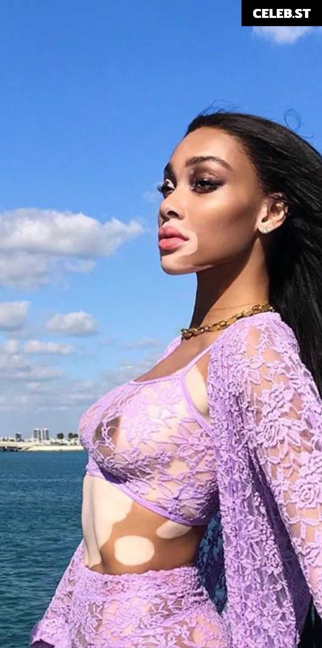 Winnie Harlow Image 1733678