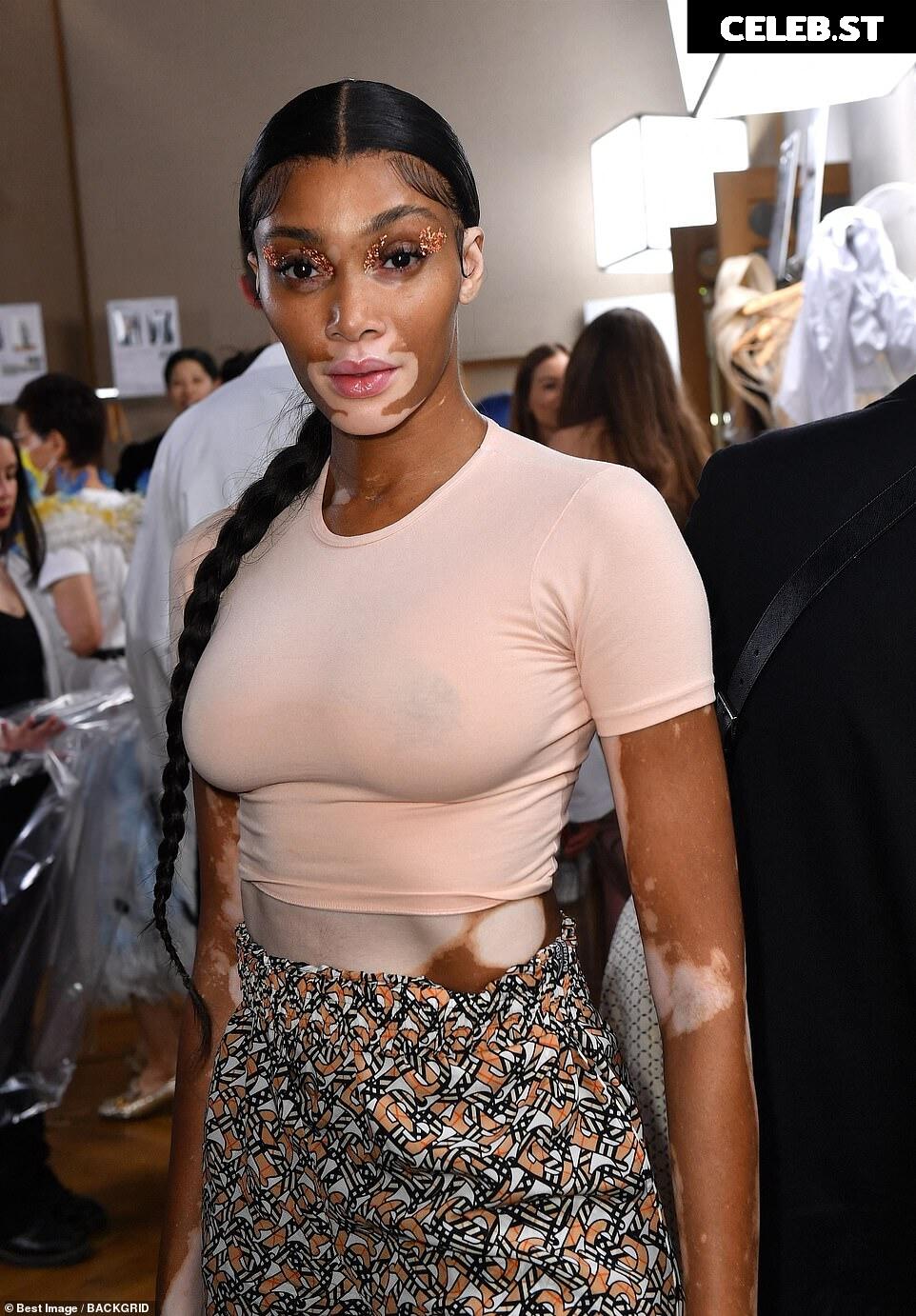Winnie Harlow Image 1733059