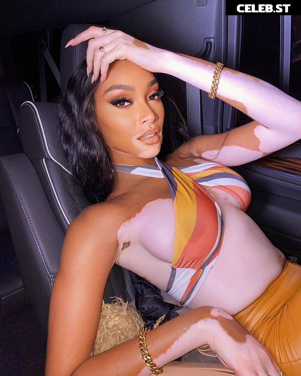 Winnie Harlow Image 1733005