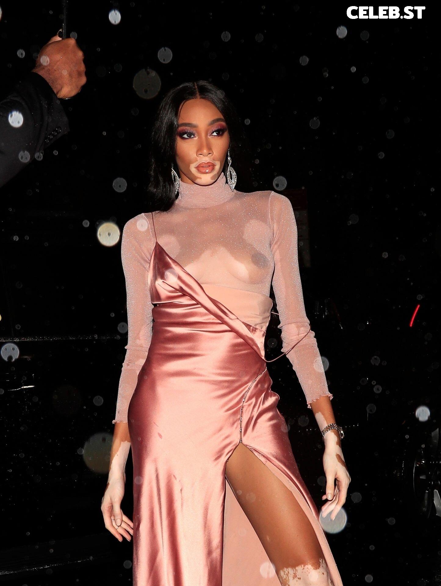 Winnie Harlow Image 1733338