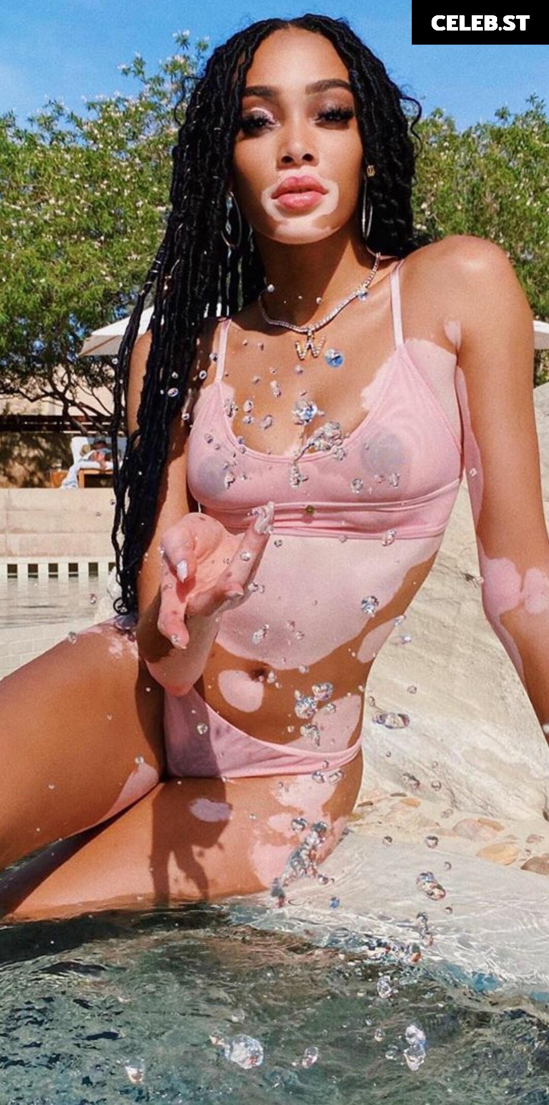 Winnie Harlow Image 1733948