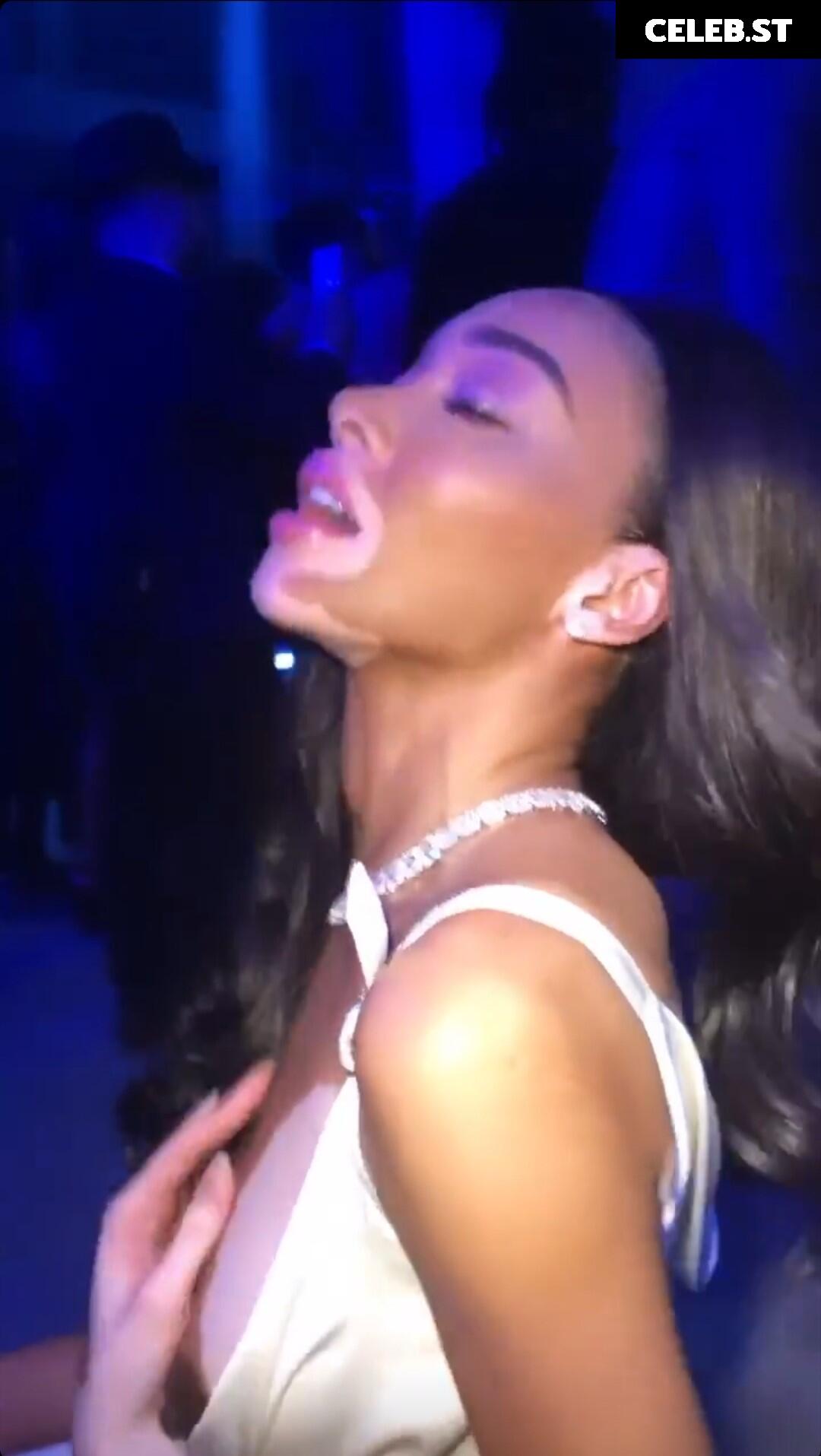 Winnie Harlow Image 1733910