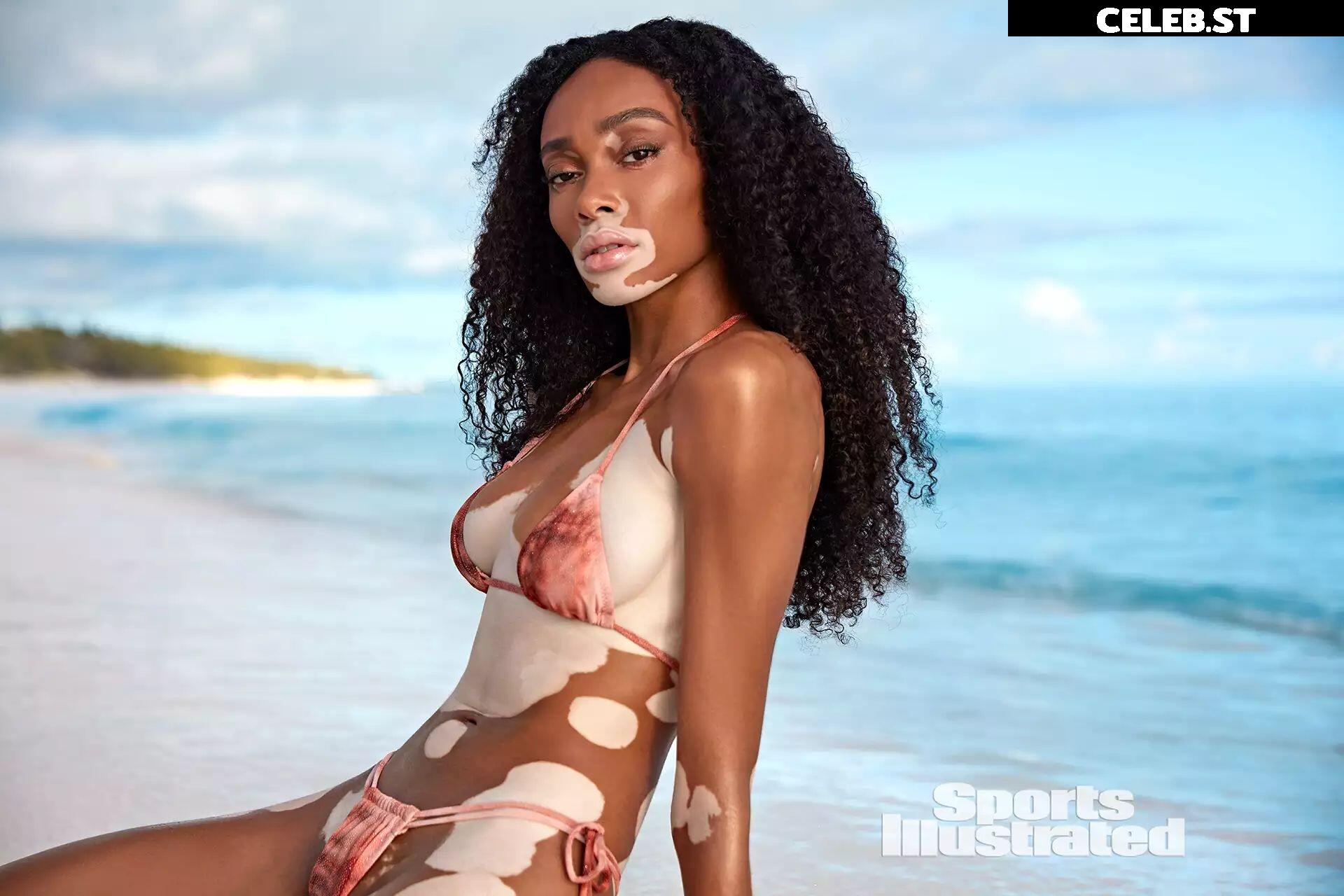Winnie Harlow Image 1730037
