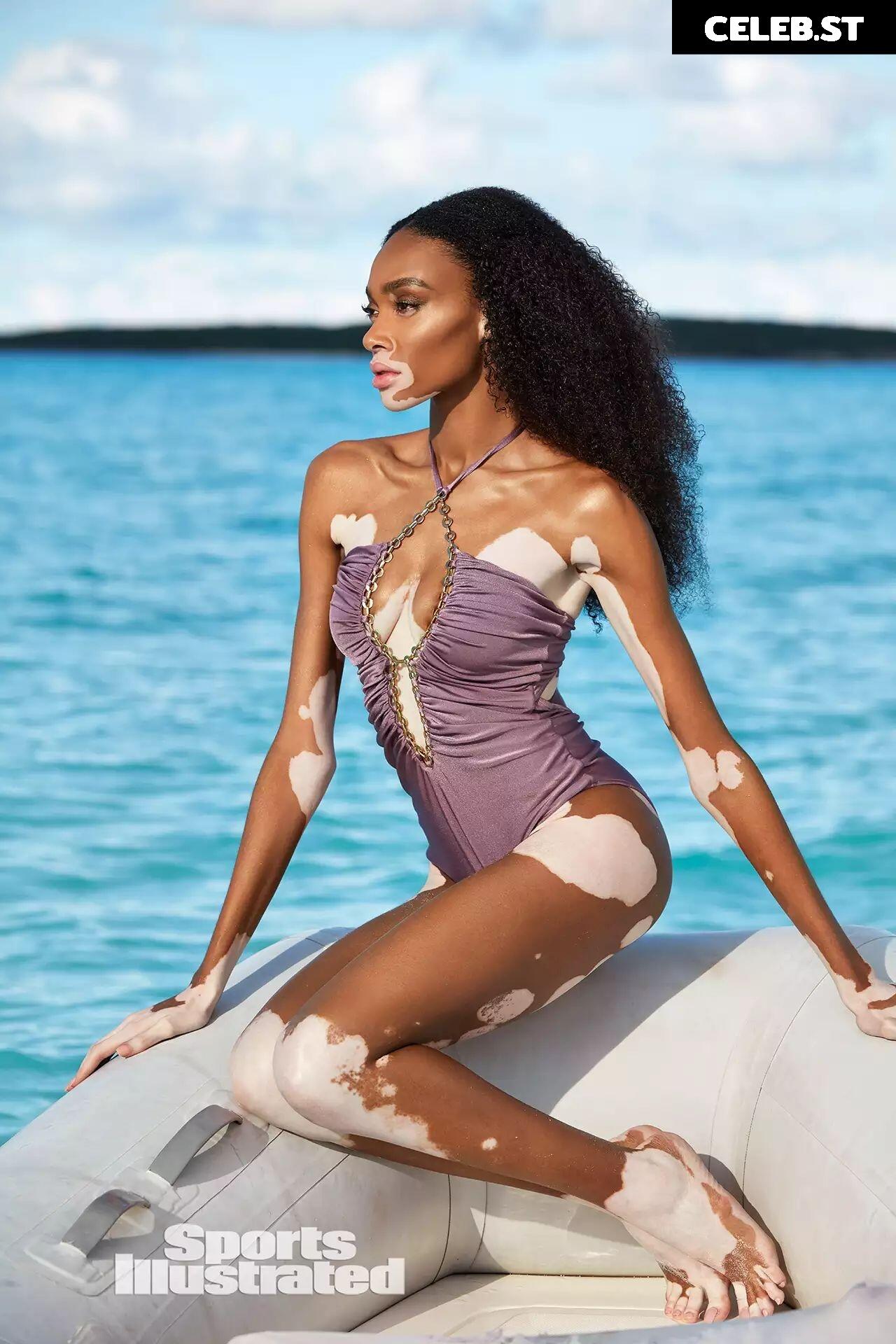 Winnie Harlow Image 1730983